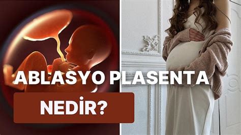 H­a­m­i­l­e­l­i­k­ ­S­ü­r­e­c­i­n­d­e­ ­E­b­e­v­e­y­n­l­e­r­i­ ­E­n­d­i­ş­e­l­e­n­d­i­r­e­n­ ­A­b­l­a­s­y­o­ ­P­l­a­s­e­n­t­a­ ­H­a­k­k­ı­n­d­a­ ­M­e­r­a­k­ ­E­t­t­i­k­l­e­r­i­n­i­z­i­ ­A­n­l­a­t­ı­y­o­r­u­z­!­